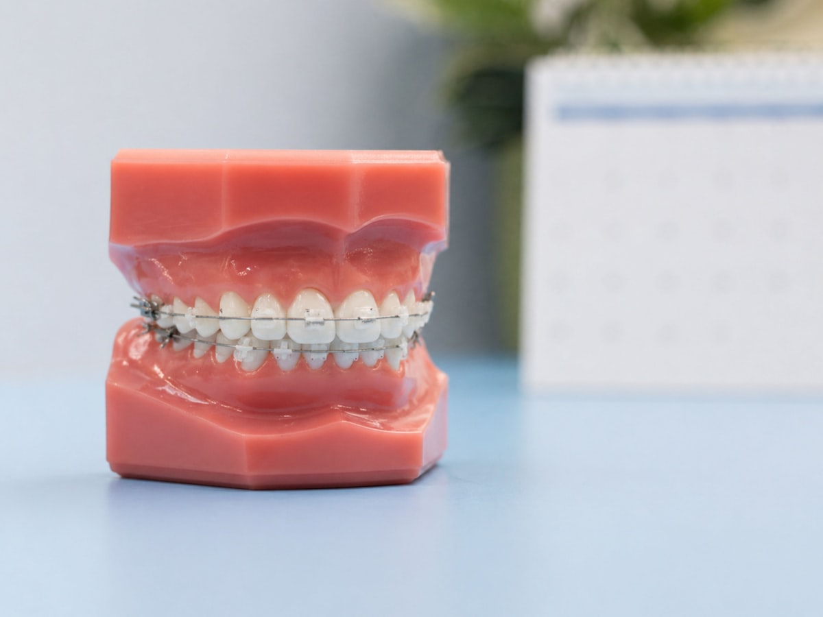 Dental model with metal braces on the teeth