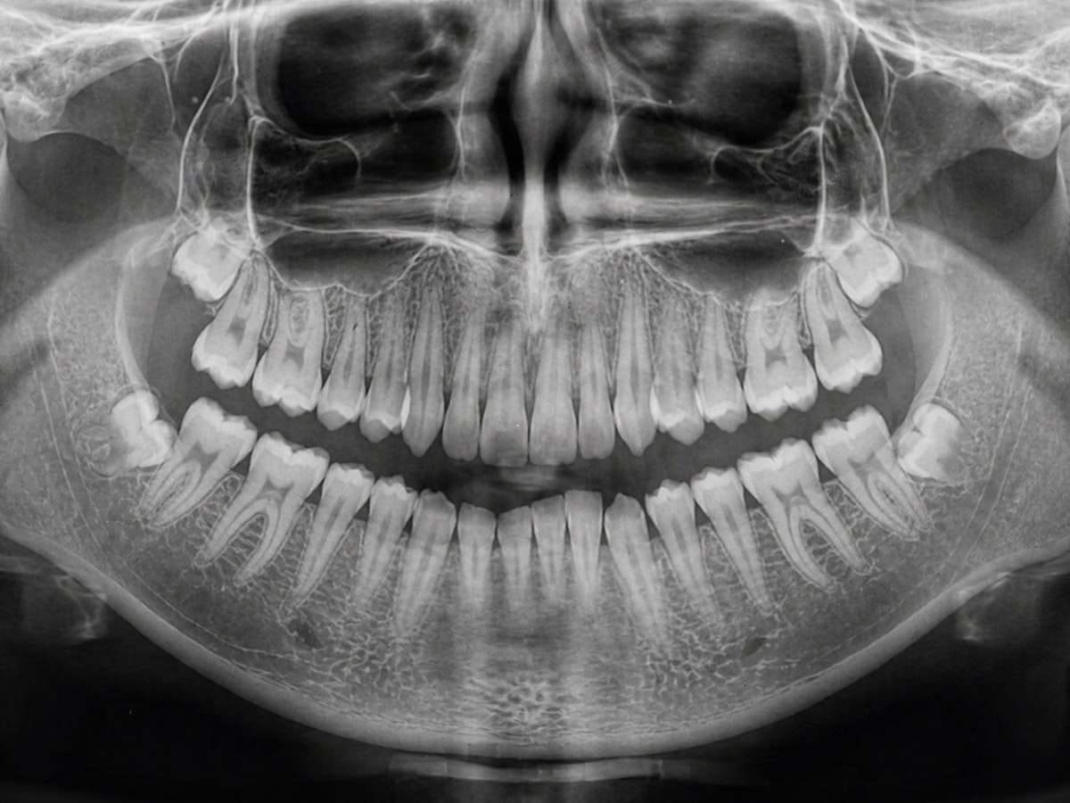 Panoramic dental X-ray of upper and lower teeth