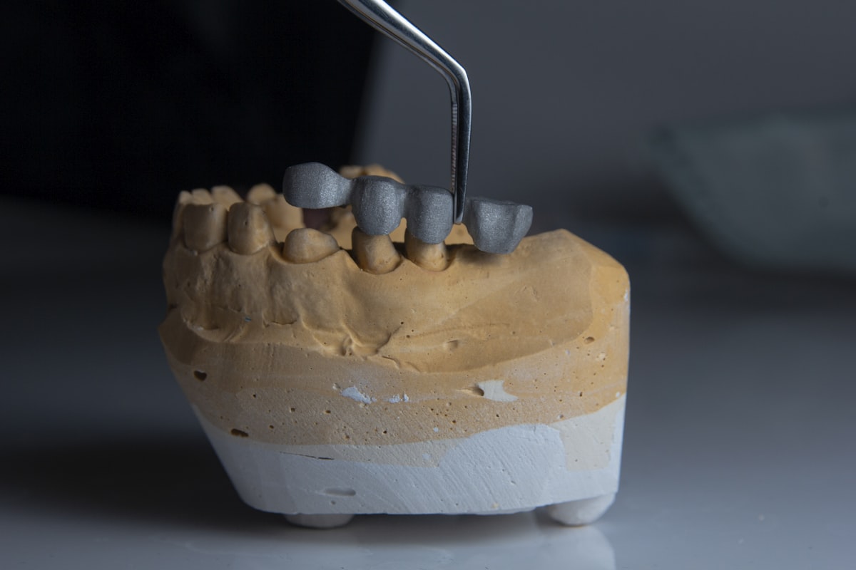Dental crowns being placed on a model with tweezers