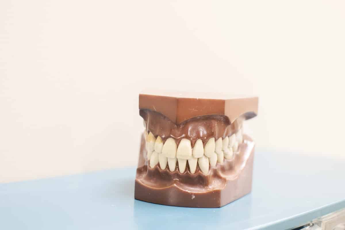 Full dental model showing upper and lower teeth