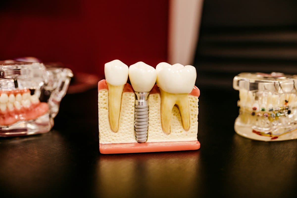 Dental teaching models of teeth, an implant and braces on a table