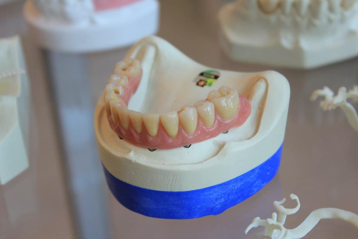 Lower denture resting on a dental lab model