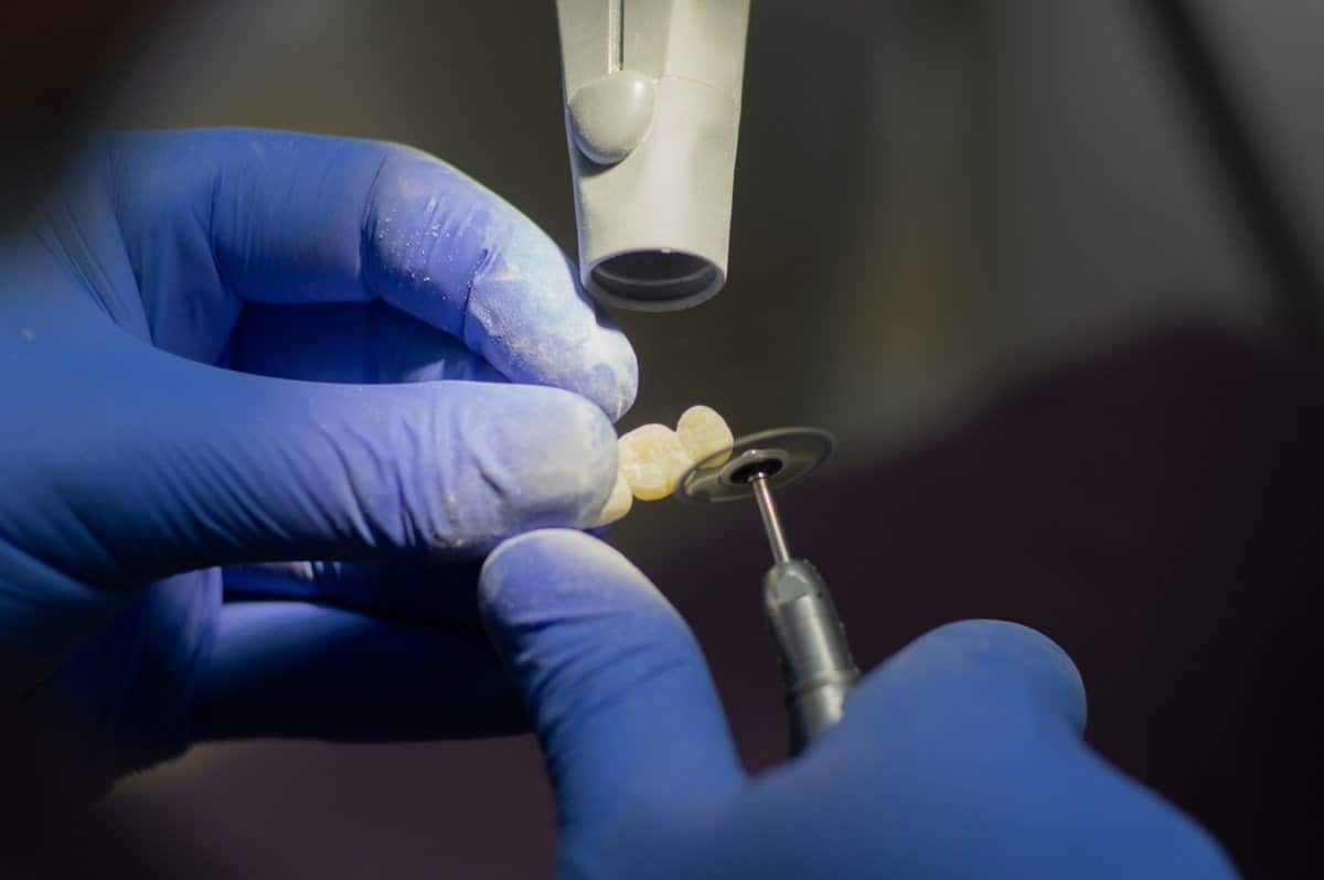 Gloved hands adjusting a small dental crown with a lab handpiece