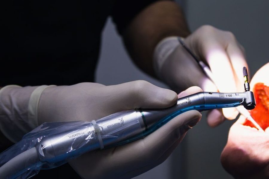 Root Canal